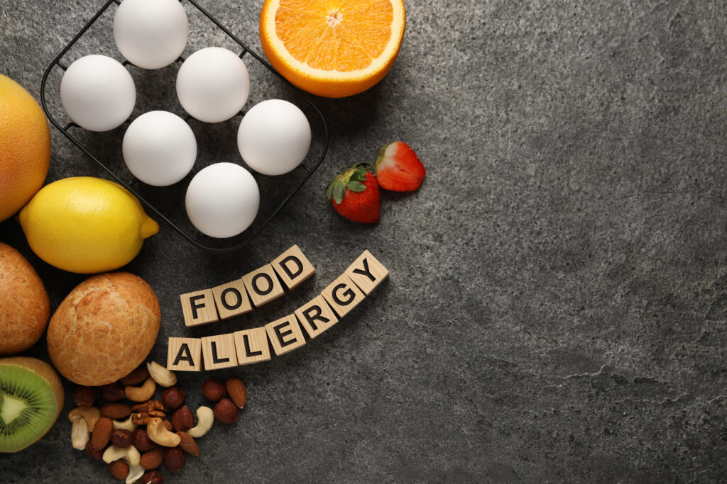 food-allergen-awareness-course